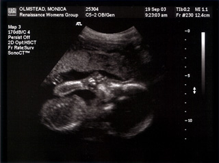 Baby Mojo